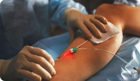 Cirurgia de safena com laser