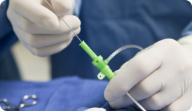 Cirurgia de safena com radiofrequência